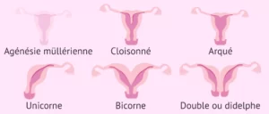 chroniques-uterines