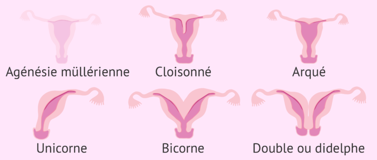 chroniques-uterines